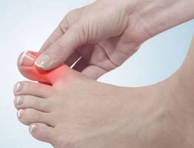 Ουρικό οξύ και διατροφή: Τι πρέπει να προσέχετε;